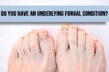fungal-condition
