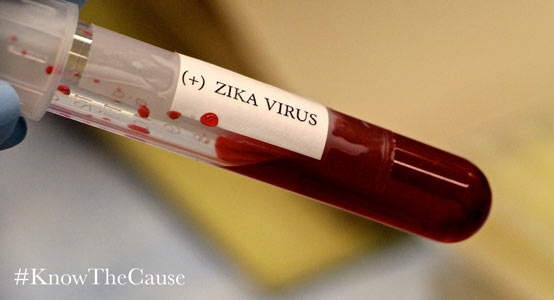 zika-virus-554px