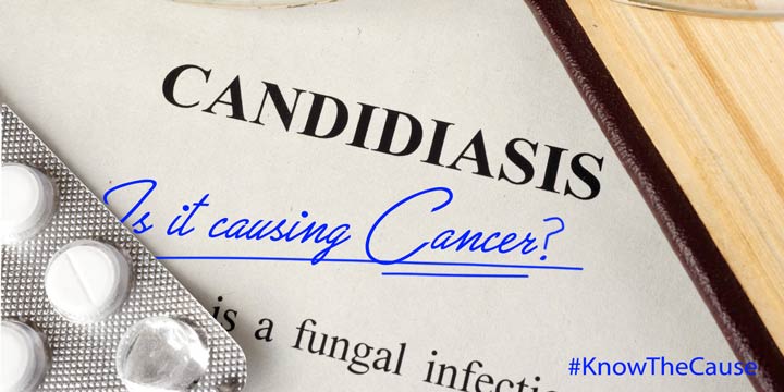 CANDIDA-increase-risk-cancer