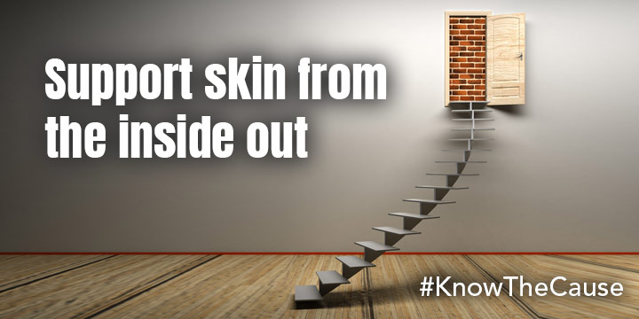 Support Skin from the Inside Out