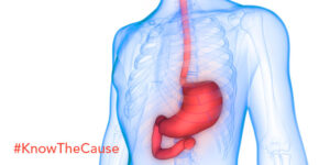Genetics And Gut Health